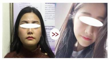 春語總院長洪偉，面部年輕化打造青春十歲的魅力